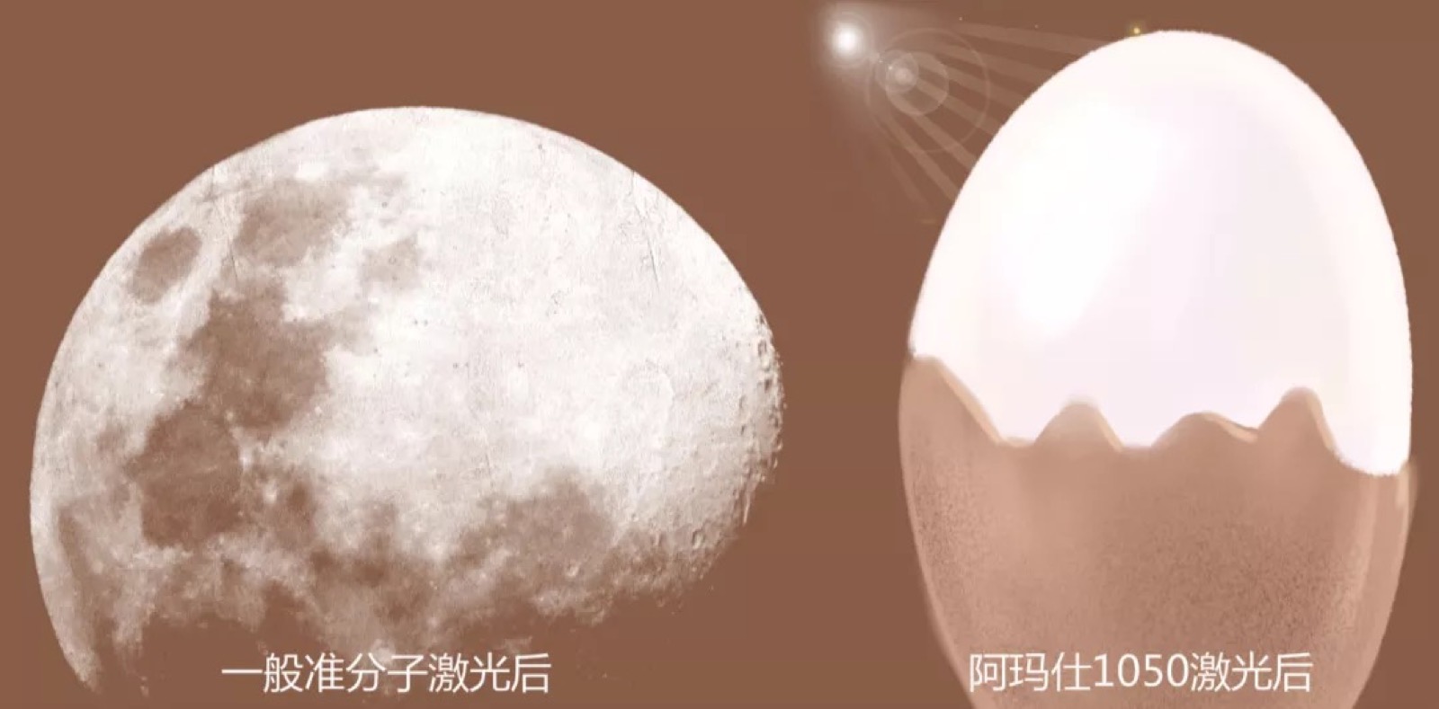 黑马眼科是谁？近视手术为什么做得好？配图