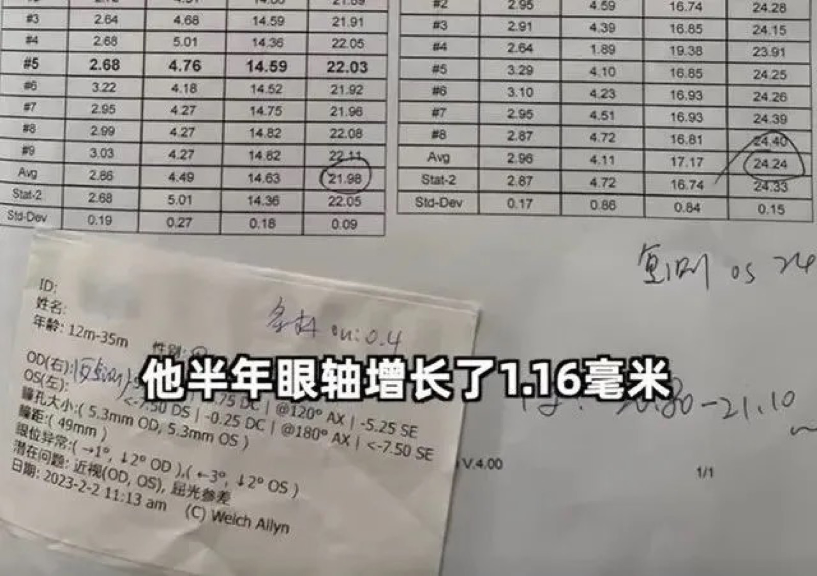 关于近视会不会遗传，大部分家长都理解错了配图