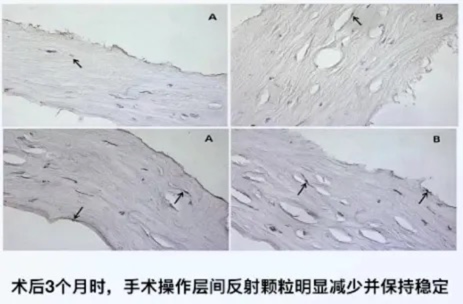 “能全飞就全飞”，要求最多的这个手术到底好不好？配图