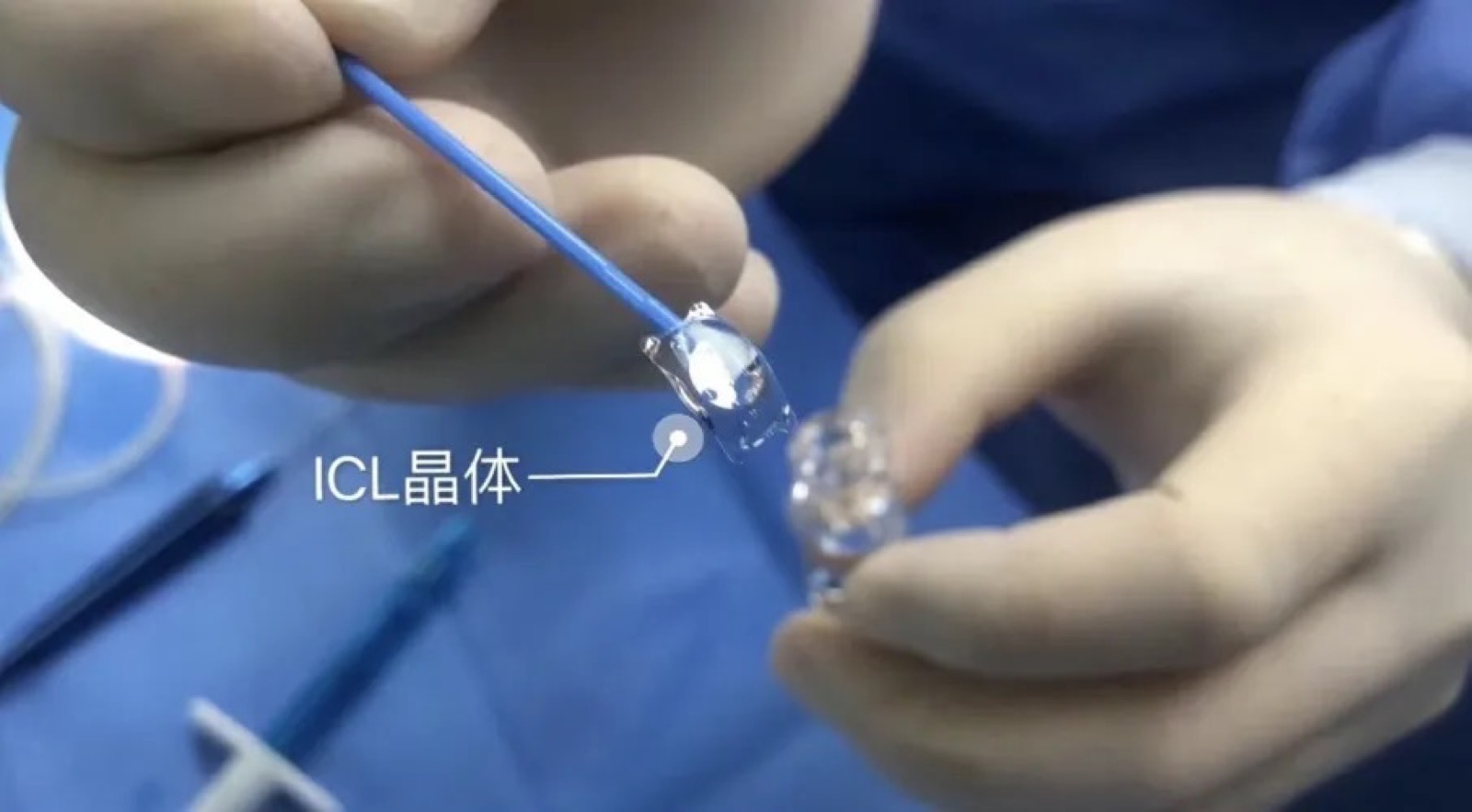 好纠结……想做近视手术，选激光，还是ICL？配图